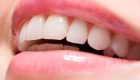 Zirconium Crowns