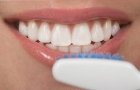 Teeth Whitening
