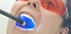 Tooth Crystal