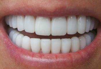 Zirconium Crowns
